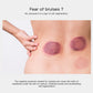 Silicone Cupping Kit (4 cups)