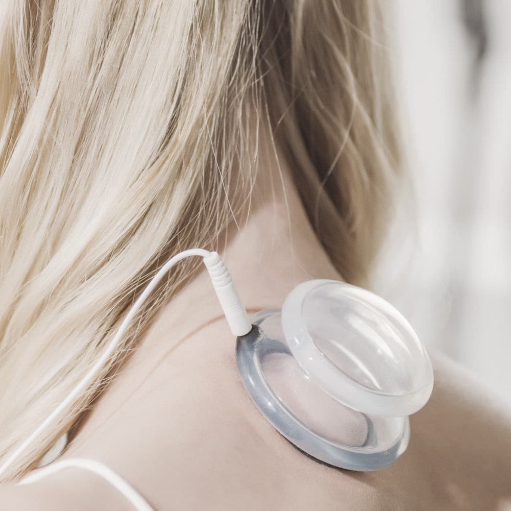 electromagnetic cupping therapy